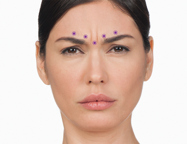 Botox and Juvederm skin rejuvenation services in Fort Worth with products from Allergan, Henry Schein and Galderma. 